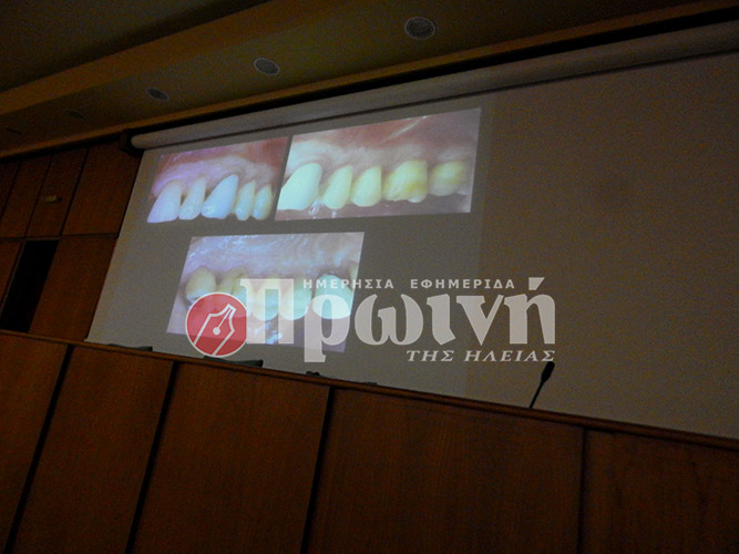 odontiatroi-periodontitida5