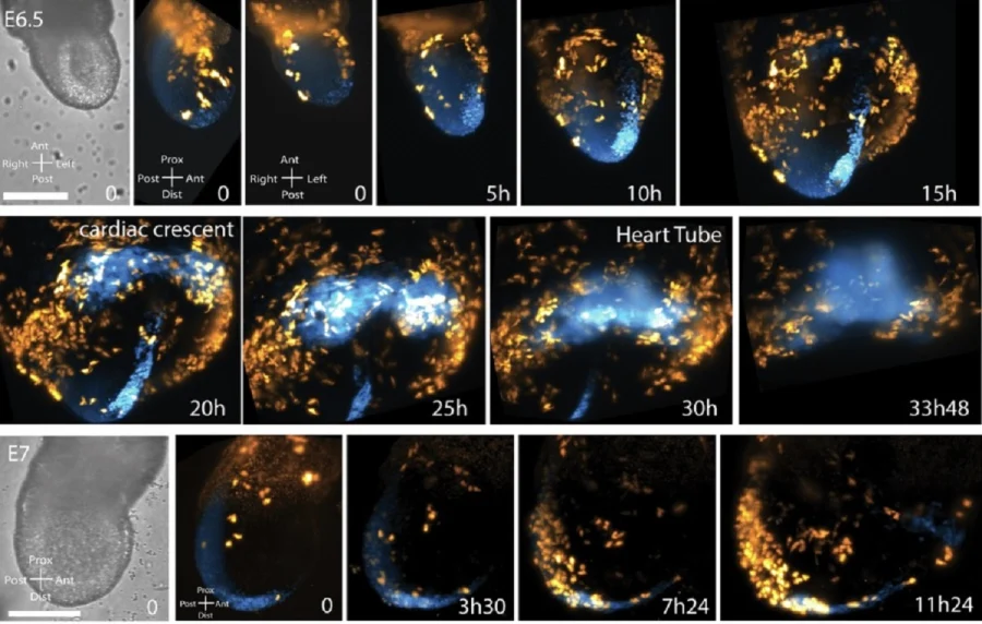 Για πρώτη φορά καταγράφηκε σε εικόνα ο σχηματισμός καρδιάς σε έμβρυο (Βίντεο)