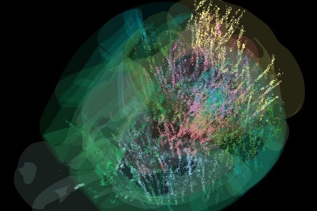 Τι συμβαίνει στον εγκέφαλο μας όταν παίρνουμε μια απόφαση – Η εντυπωσιακή φωταγώγηση