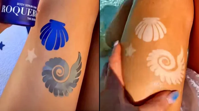 «Τατουάζ του ήλιου»: Η επικίνδυνη τάση του TikTok στη Γαλλία
