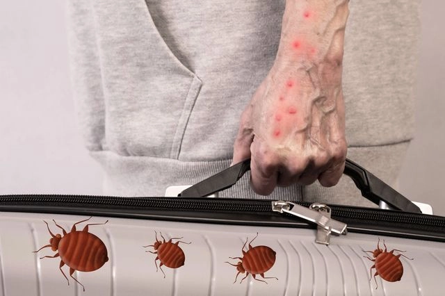 Κοριοί στις βαλίτσες μας: Ο νέος εφιάλτης των διακοπών – Πώς θα προστατευτούμε