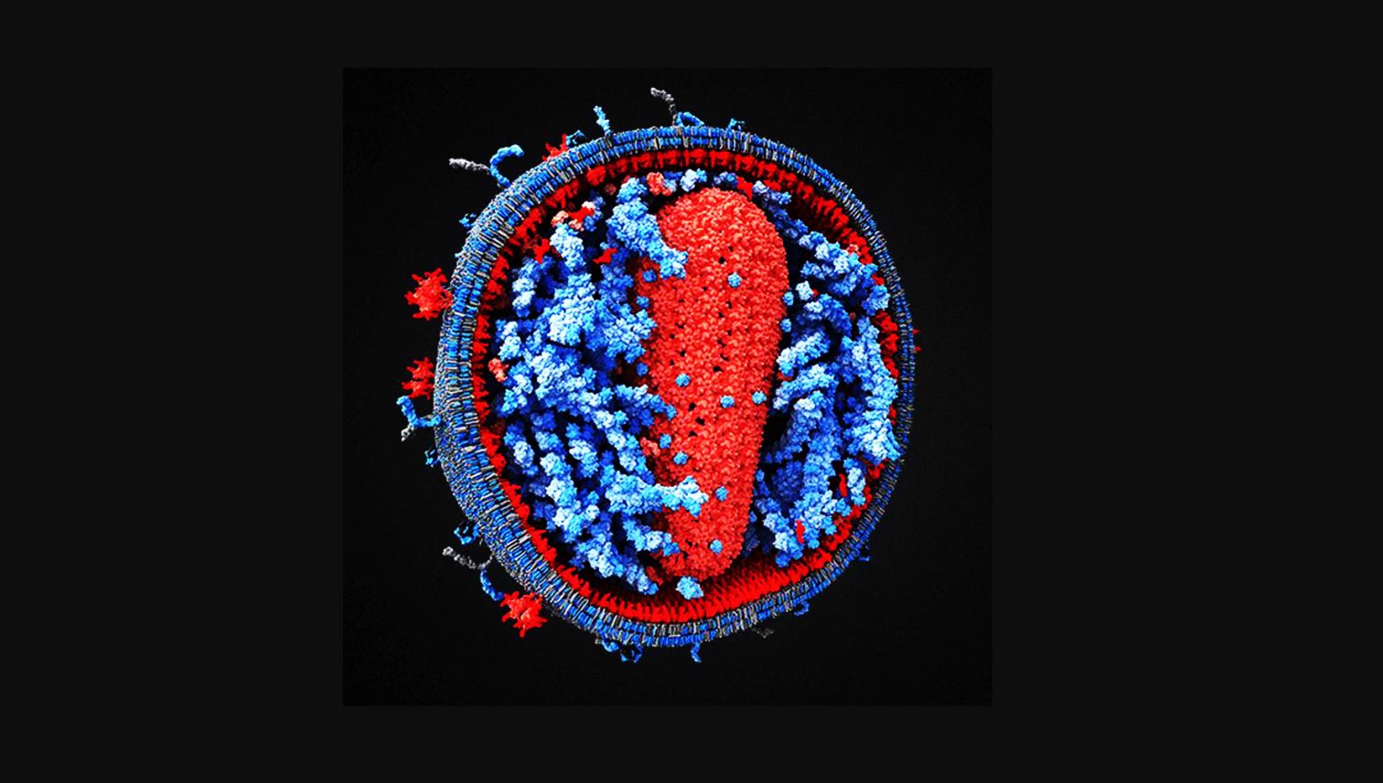 Τι είναι ο μεταπνευμονοϊός που ανιχνεύθηκε και στην Ελλάδα