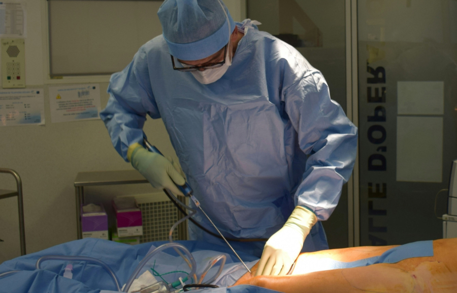 Ένας αλγόριθμος γνωρίζει τι θα συμβεί κατά τη λιποαναρρόφηση πριν καν αυτή ξεκινήσει